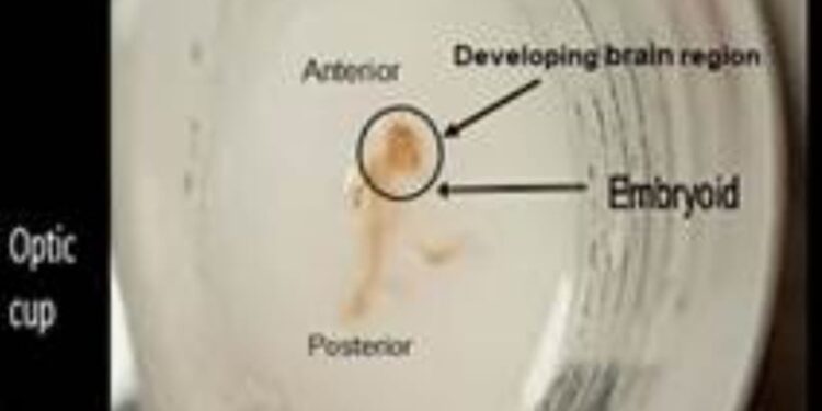 मेडिकल -ऑटोलॉगस रक्त से न्यूरोवास्कुलर ऊतक/ऑर्गेनॉइड उत्पन्न करने के लिए विकसित नया प्रोटोटाइप सटीक दवा में कर सकता है मदद