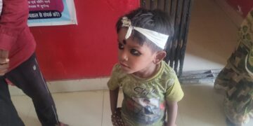 रानीगंज – आंगनबाड़ी सेविका का तुगलकी फरमान पिटाई करके बच्चें का सिर फोड़ा