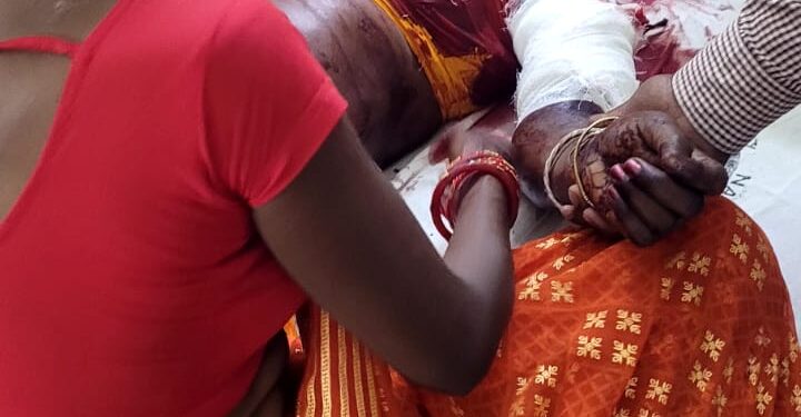 गोदाम चौक के पास सड़क दुर्घटना में महिला दुर्घटनाग्रस्त