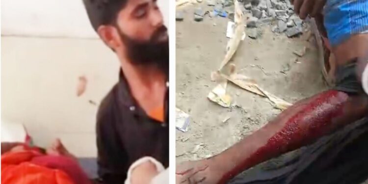 ताराबाड़ी- पुलिस की फायरिंग में एक पुरूष व एक महिला को लगी गोली, प्रशासन मौन।