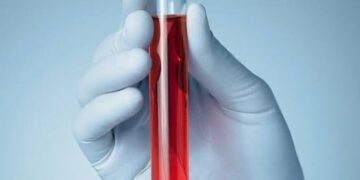 हीमोग्लोबिन का स्तर 7 से कम होते ही विशेष निगरानी में रहेंगी गर्भवती