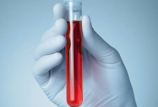 हीमोग्लोबिन का स्तर 7 से कम होते ही विशेष निगरानी में रहेंगी गर्भवती