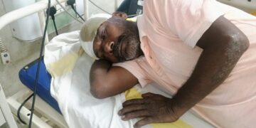 आमगाछी में पुरानी रंजिश को लेकर घर में घुसकर मारपीट व लूटपाट, दो घायल