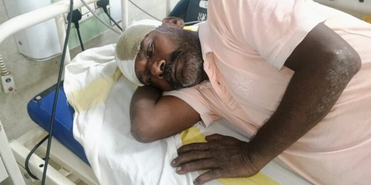 आमगाछी में पुरानी रंजिश को लेकर घर में घुसकर मारपीट व लूटपाट, दो घायल