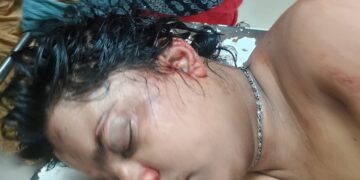 अररिया – जोकीहाट में सड़क हादसा, बाइक सवार गंभीर रूप से घायल