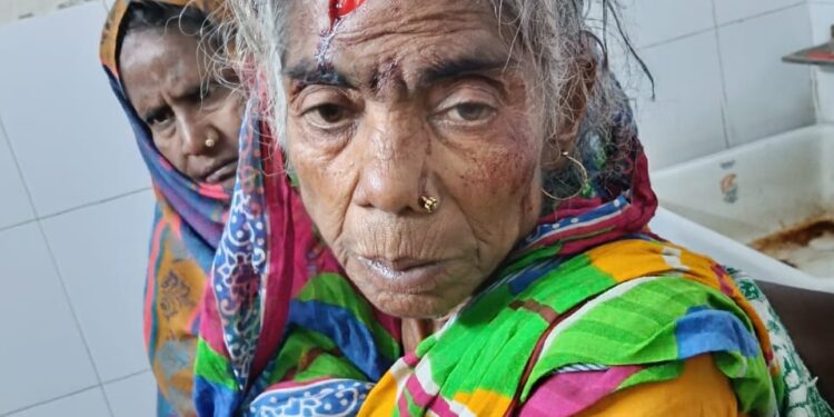 बारसोई, कटिहार – पागल कुत्ते का कहर आधा दर्जन लोगों किया घायल, दो की हालत गंभीर